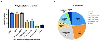 Arrhythmia Patterns in Patients on Ibrutinib